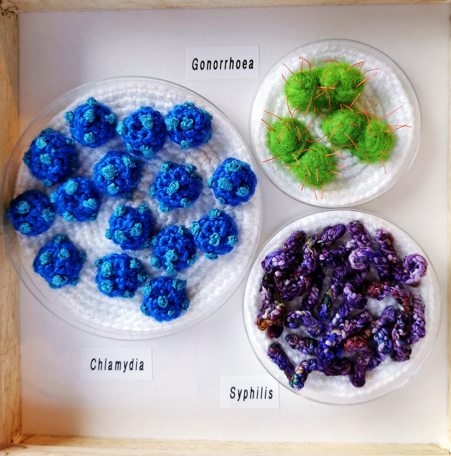 STI Framed Petri Dish Set