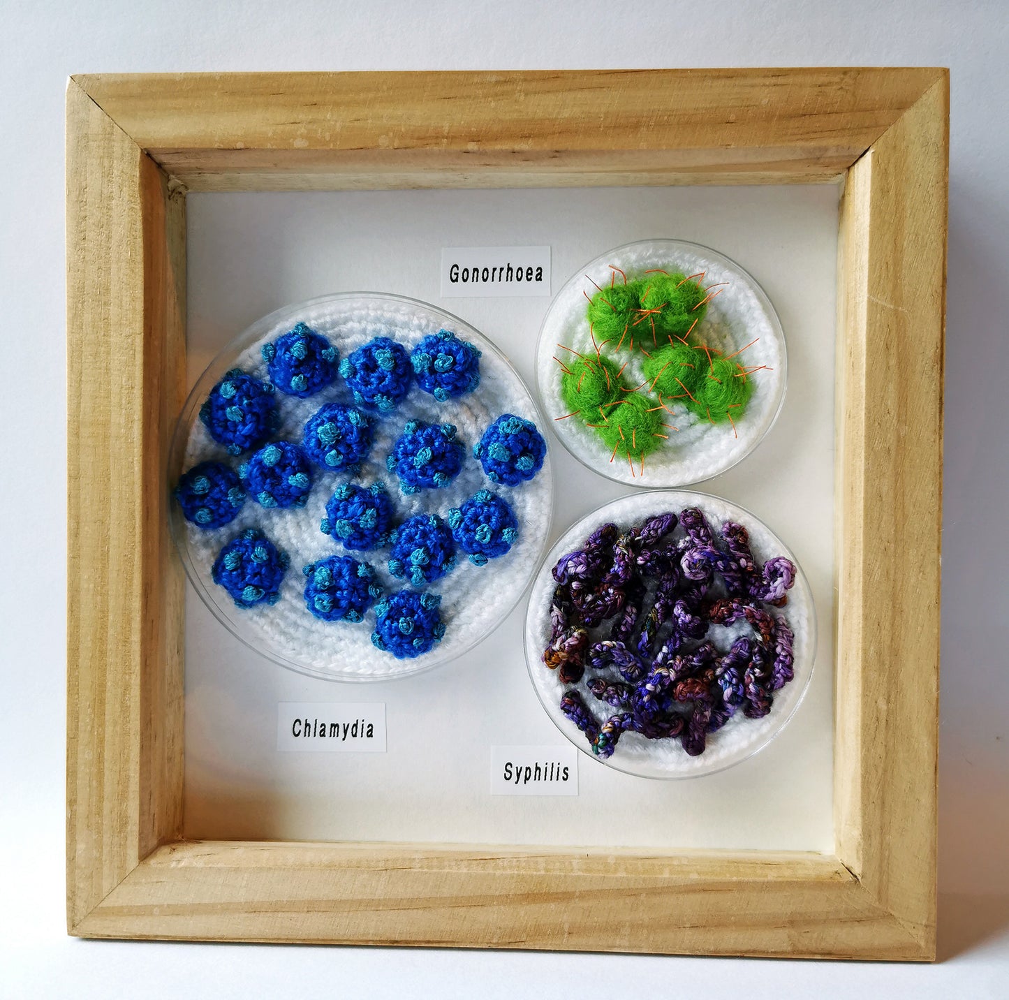 STI Framed Petri Dish Set
