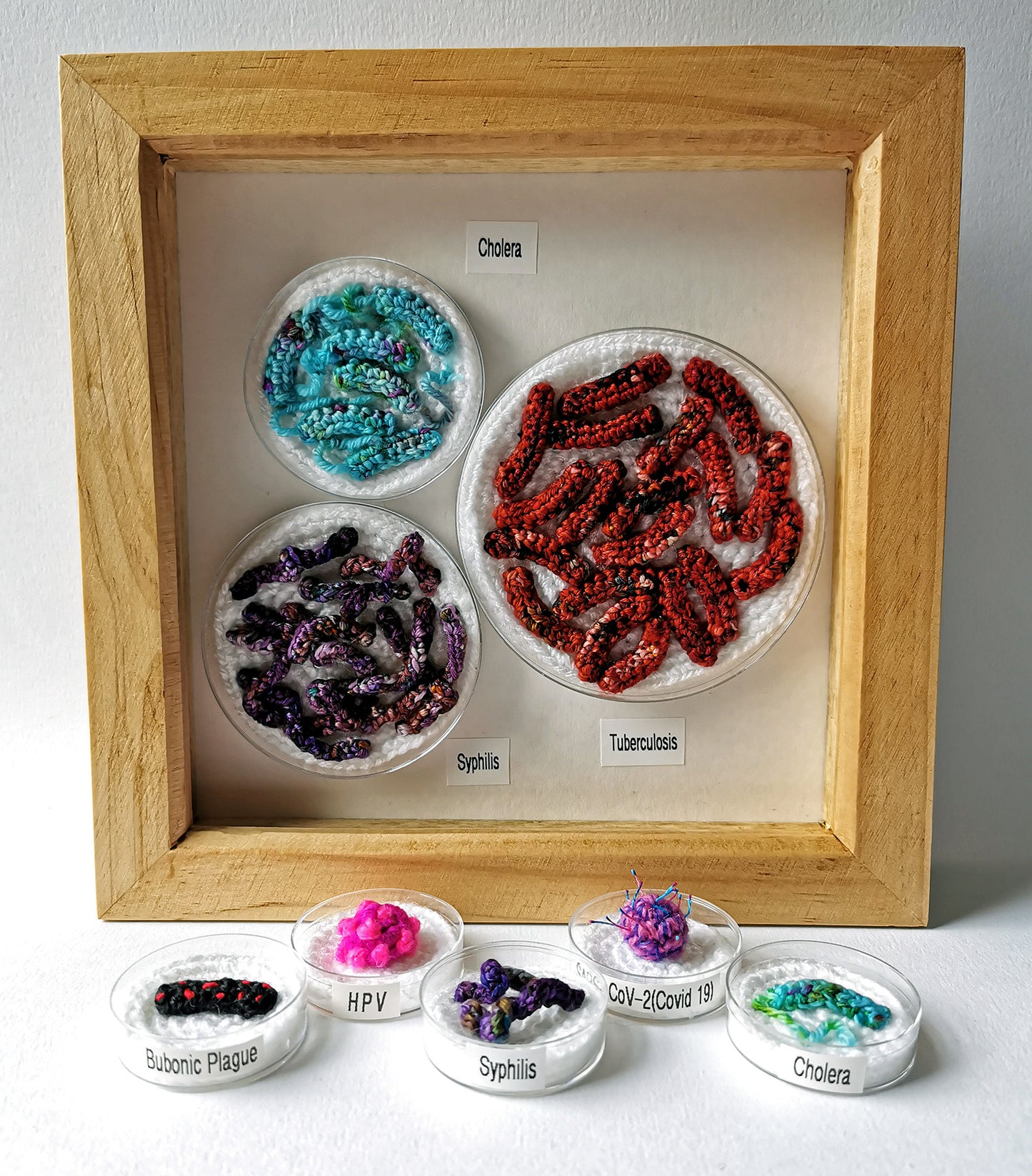 'Victorian Diseases' Framed Petri Dish Set